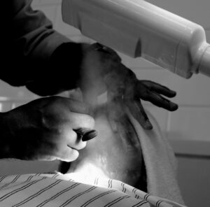 脇毛剃ると痛い原因と対策は？